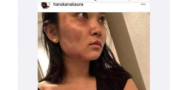 蒋勁夫(ジャンジンフー)が中浦悠花にDVで謝罪!アザ顔画像は?